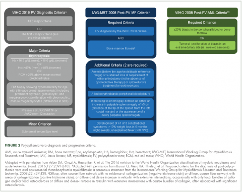 Figure 2 Polycythemia vera diagnosis and progression criteria