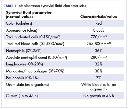 Table Left olecranon synovial <?AID 001f?>uid characteristics