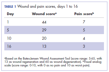 Table 1. Wond and pain scores