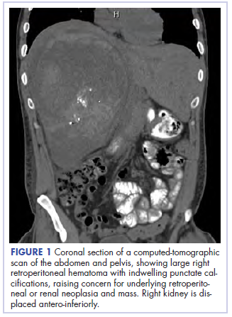 Figure 1 Yellala