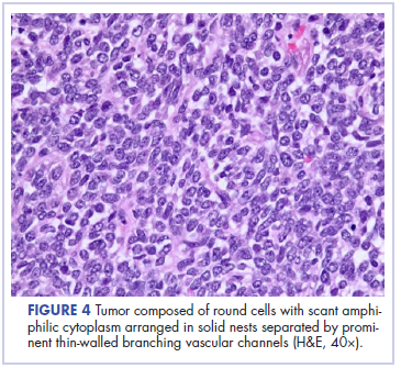 Figure 4 Yellala