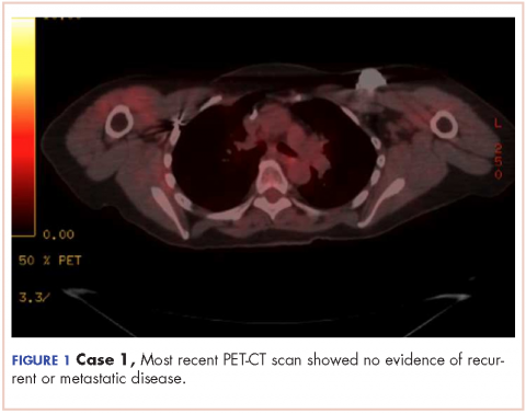 Figure 1, Case 1 Recent PET-CT scan showing no metastatic disease