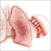 Should you reassess your patient’s asthma diagnosis?