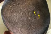 yellow arrows pointing in hair