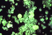 Cytomegalovirus particles glowing through the use of an immunofluorescent technique, magnified at 25X.