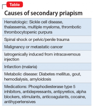 Causes of secondary priapism