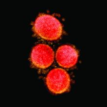 Transmission electron micrograph of SARS-CoV-2 virus particles