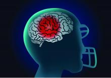 A graphic illustration of the brain of an American football player.