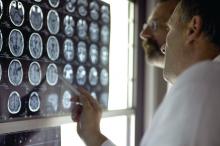 Doctors review brain scans