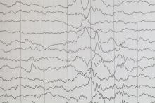 Brain wave on electroencephalogram, EEG wave background.