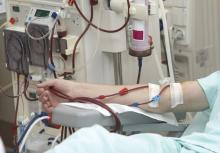 Arm of a patient on dialysis