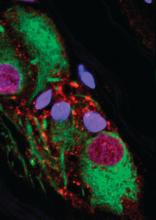 Staining revealed that healthy appendixes contain alpha - synuclein (red), a protein that is a constituent of the Lewy bodies observed in Parkinson's disease