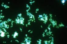 This image shows a positive fluorescent antibody test for the Gram-negative bacterium Neisseria gonorrhoeae.