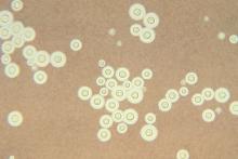 Cryptococcus neoformans is the most common cause of cryptococcal meningitis in patients with HIV.