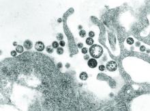 Transmission electron micrograph shows Lassa fever virons among cellular debris.