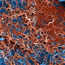 Ebola virus particles (red).
