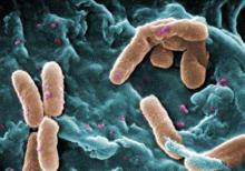 Pseudomonas is often isolated from stool samples, but is not normally found in a child’s respiratory tract.