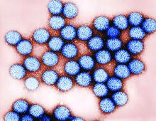 Transmission electron micrograph of intact rotavirus double-shelled particles.