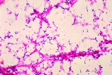 Streptococcus pneumoniae