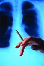 A person's hand holds cigarette with lung xray in background.