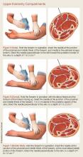 Upper extremity compartments