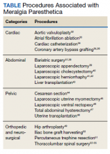 Procedures Associated with Meralgia Paresthetica