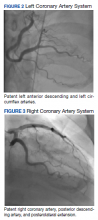 Left and Right Coronary Artery System figure