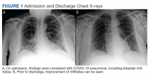 Admission and Discharge Chest X-rays figure