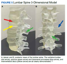 Lumbar Spine 3-Dimensional Model