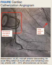 Cardiac Catherization Angiogram