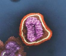 This negative-stained transmission electron micrograph (TEM) depicts the ultrastructural details of an influenza virus particle, or “virion.”