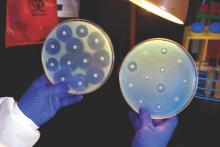 A CDC microbiologist holds up a Petri dish, on the right, inoculated with a CRE bacterium that proved to be resistant to all of the antibiotics tested.