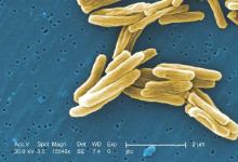 This colorized scanning electron micrograph depicted some of the ultrastructural details seen in the cell wall configuration of a number of gram-positive Mycobacterium TB bacteria.