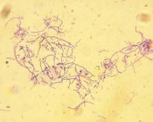 The anthrax-causing bacterium Bacillus anthracis, viewed through a microscope.