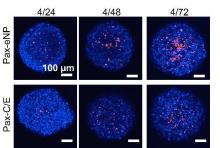 Human malignant mesothelioma spheroids treated with Pax-eNPs demonstrated caspase-3 up-regulation from negligible within the 24 hours after Pax-Rho-eNP treatment to significantly increased at 46 and 72 hours compared with Pax-C/E.