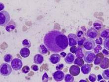 A small, hypolobated megakaryocyte (center of field) in a bone marrow aspirate, typically of chronic myelogenous leukemia.