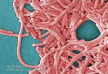 This image depicts a large grouping of Gram-negative Legionella pneumophila bacteria.