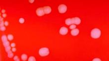 Neisseria meningitidis colonies are shown on a blood agar plate.