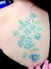 Multicolored tattoos are increasingly popular; the need for effective removal modalities is likely to grow as well. 