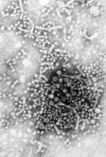 This negatively stained transmission electron micrograph revealed the presence of numerous hepatitis B virus virions, also know as Dane particles. HBV contains a genome of DNA.