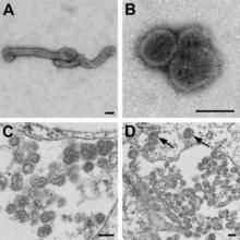 Electron microscopic images of novel Thogotovirus isolate. Virus particles (A and B) are visible in culture supernatant. Thin-section specimens (C and D) show extracellular virions. Arrows indicate endocytosed virus particles.