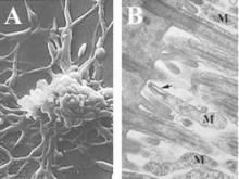 Image A shows filamentous M. pneumonia. Image B shows M. pneumonia (M) attached by the terminal tip organelle (arrow) to ciliated mucosal cells.