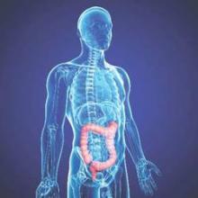 Users of aspirin or COX-2 inhibitors appear less likely to have a recurrence of stage III colon cancer.