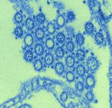 This highly magnified, digitally colorized transmission electron micrograph depicted numbers of virions from a novel flu H1N1 isolate.