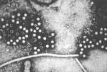 Electron micrograph of Hepatitis E viruses (HEV).