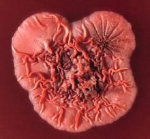 Surface of a Penicillium marneffei colony.