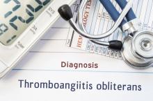 Stethoscope above the words Thromboangiitis obliterans