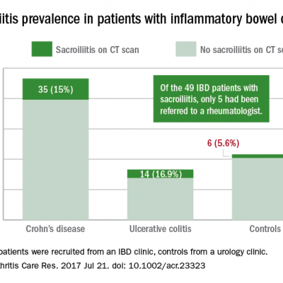 CT scoring system may improve sacroiliitis treatment in IBD | Clinician ...